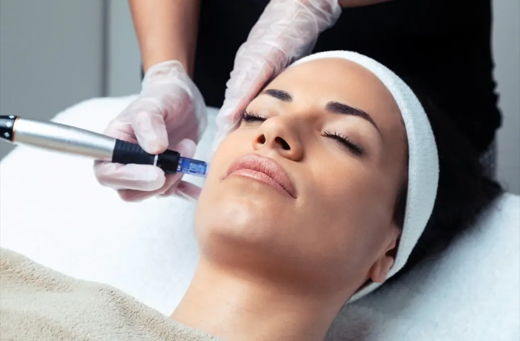 Microneedling with Exosomes