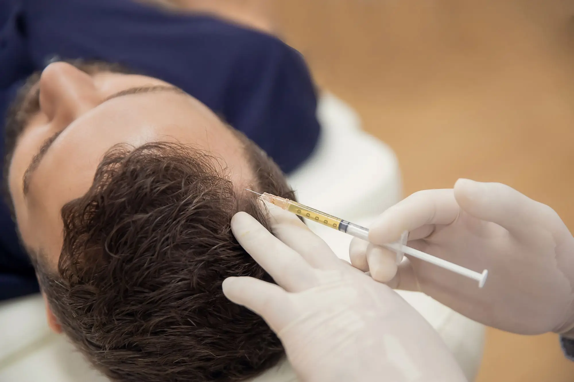 Hair Exosome Therapy