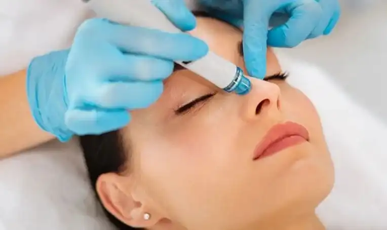 Hydrafacial treatment