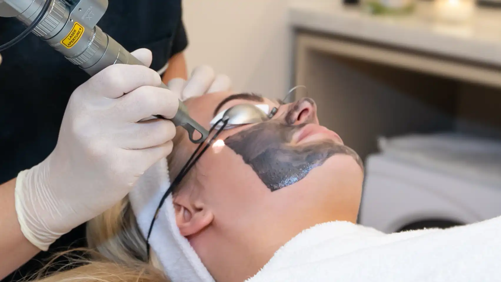 Hollywood Peel treatment
